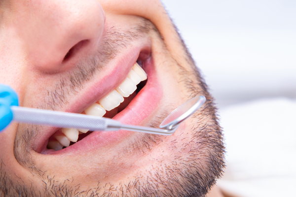 All On   Can Replace Multiple Teeth