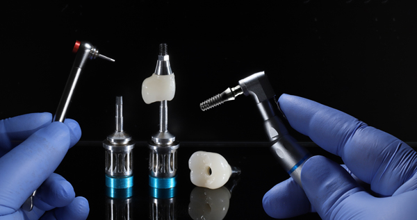FAQs About Tooth Implants