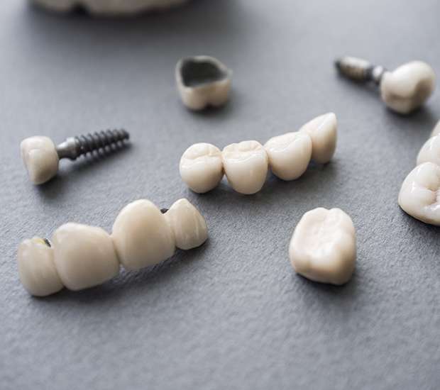 Camas The Difference Between Dental Implants and Mini Dental Implants
